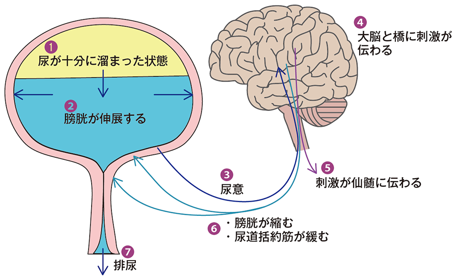 がん患者さんの排尿障害 | がん情報サイトAssist