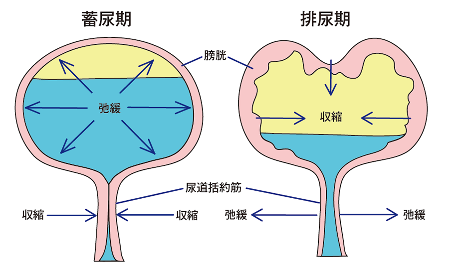 排尿障害の主な症状 | がん情報サイトAssist